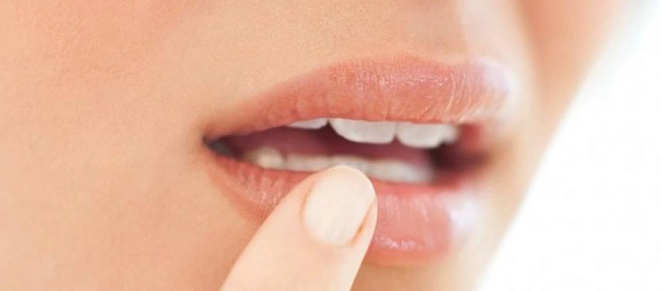 Επιχείλιος έρπης: Αίτια και πως να τον αντιμετωπίσετε